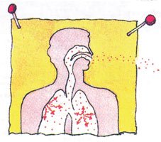 radon lungs